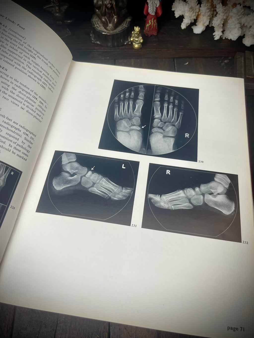 Positioning in Radiography – K. C. Clark M.B.E., F.S.R. (1960) – Seventh Edition – Vintage Medical Textbook
